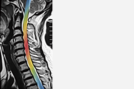 Spinal cord neural activity